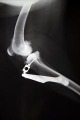 Radiographie genoux rambouillet